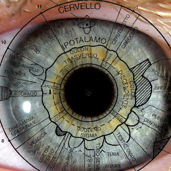 Iridologia_02